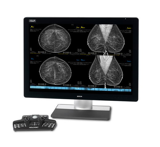 Hologic SecurView® Breast Imaging Workstation in white background